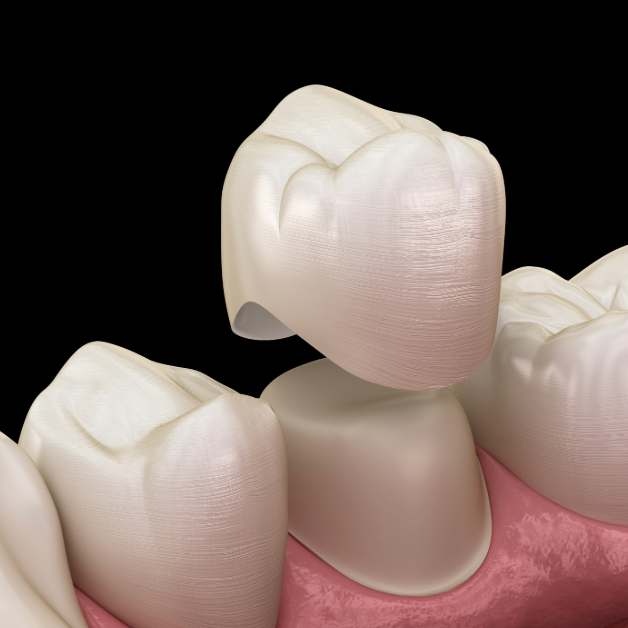 dental crowns at Integrated Dental Care