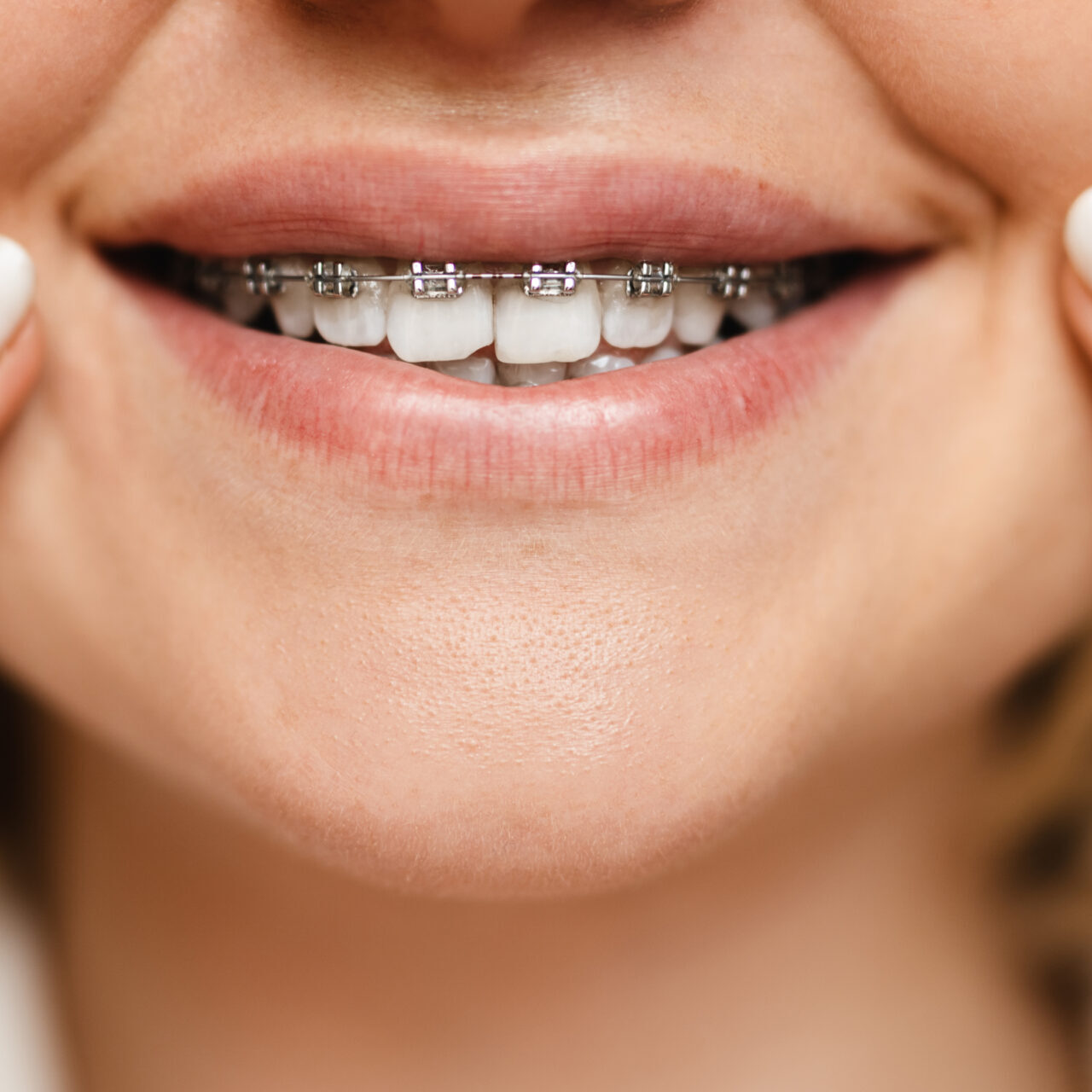 braces dentist pakenham