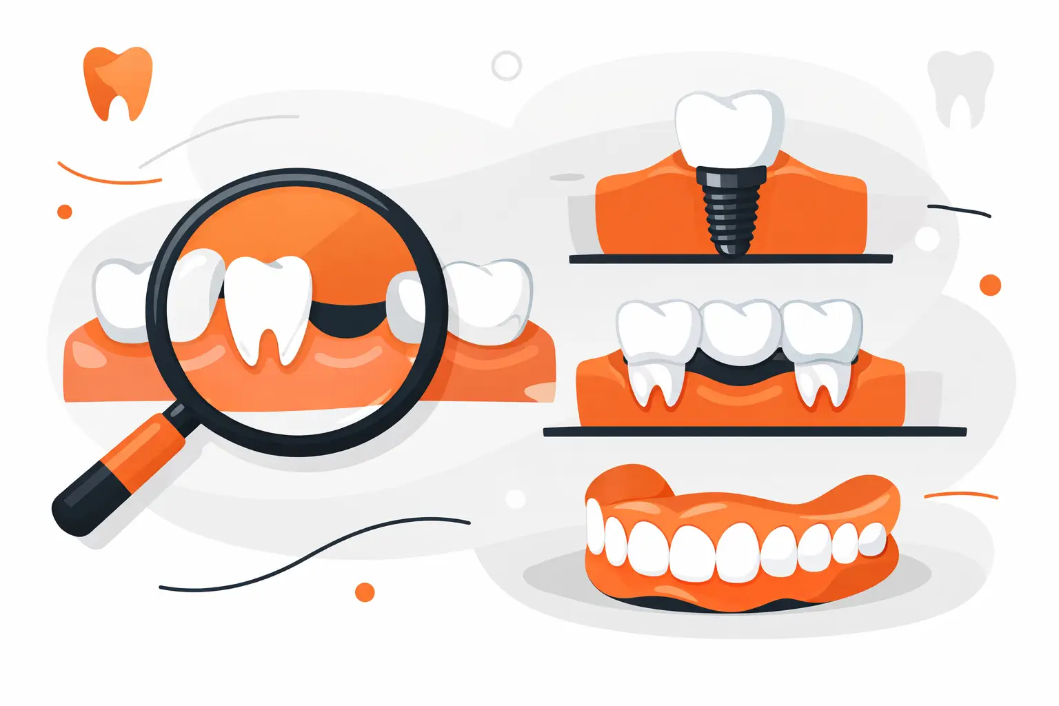 Best Replacement Options For Missing Teeth