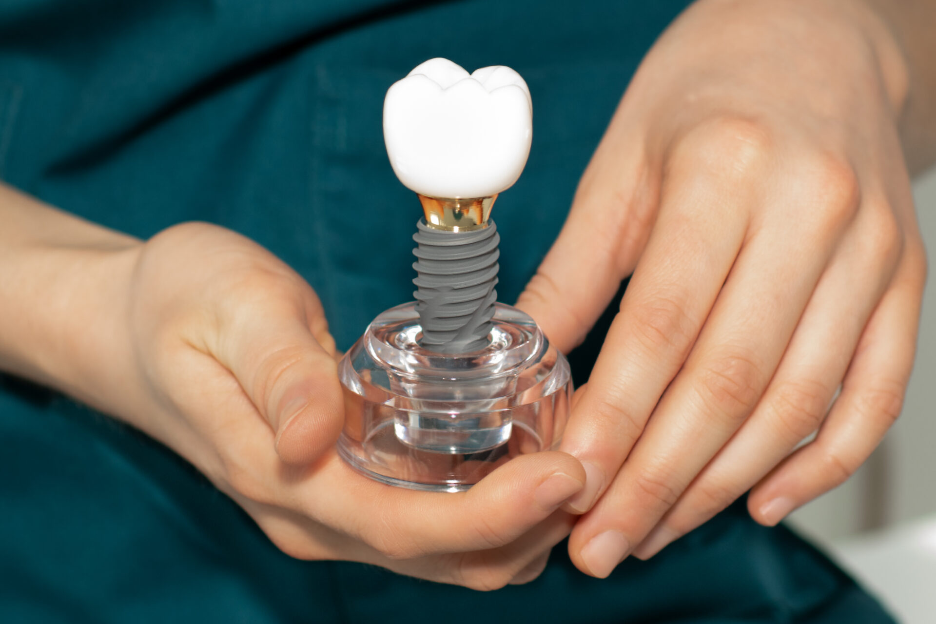 dentures vs dental implant missing teeth - pakenham dentists