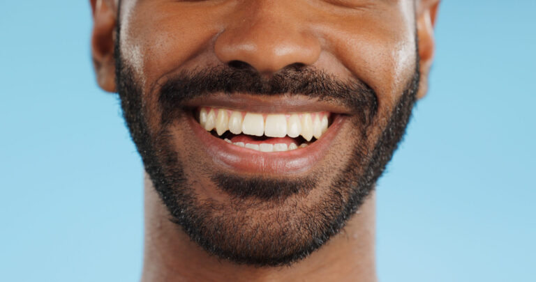 Composite Bonding at Integrated Dental Care Composite Bonding at Integrated Dental Care