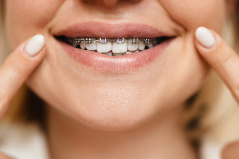 braces dentist pakenham