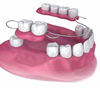 dentures pakenham