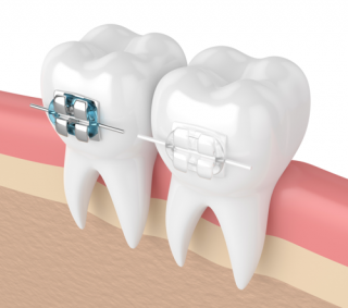 orthodontics pakenham